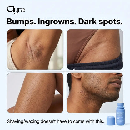 Clyra SoftGlide | Smoothing Solution Ingrown Hair Treatment